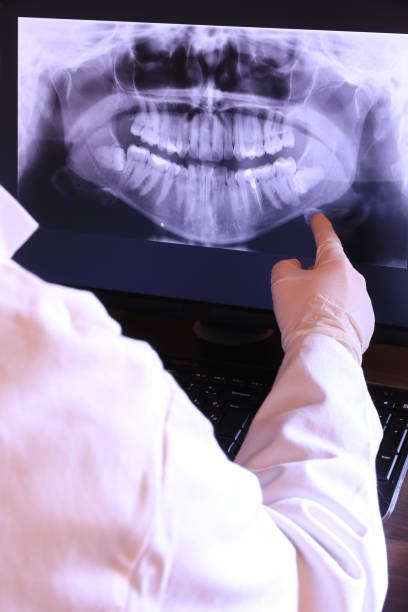 Best Broken or Cracked Tooth Emergency Dentist in Larchmont, NY
