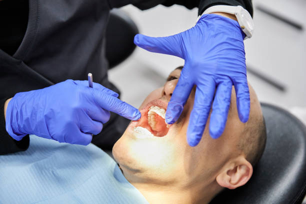 Best Emergency Dental Care for Abscessed Tooth in Larchmont, NY